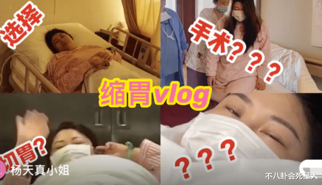 切胃、剪肠齐上阵，这些明星却越来越发福、脸垮、变样，白费劲了