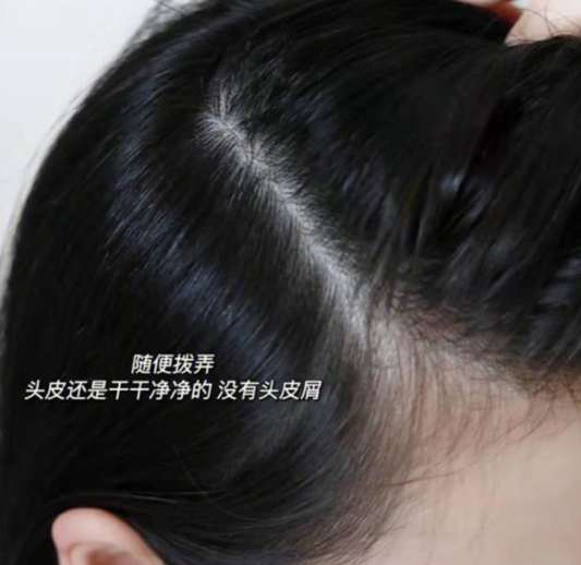 地瓜 杠精辣妈在线吐槽：海飞丝“雪花飘飘”，蜂花“脱发”神器
