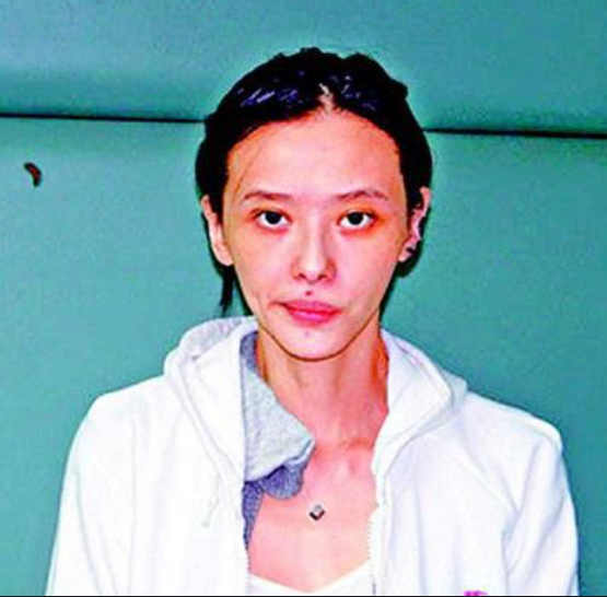 最佳女配|萧淑慎：曾2次获得最佳女配，44岁因患癌日渐消瘦，还被切除多个器官！