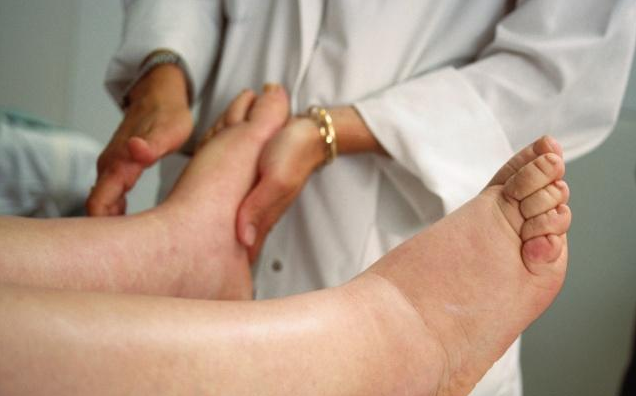 黄柏|不论男女,腿上出现这2个信号,心衰可能真的不远了