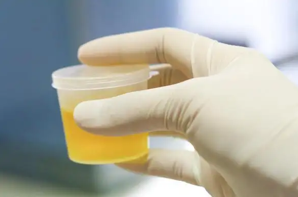 肝脏|多家医院联合呼吁：不想肝脏“硬如石头”，夏季少吃3食物，转告家人