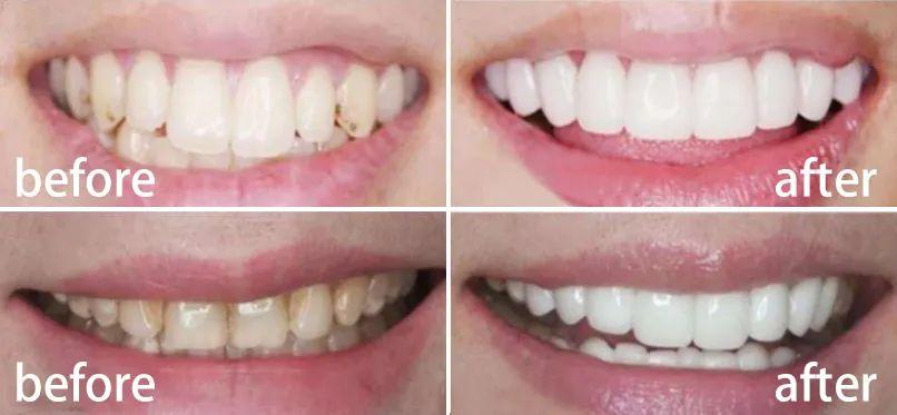 因“廉价”被人瞧不上的3个小物件,用过才知道,便宜也有好货!