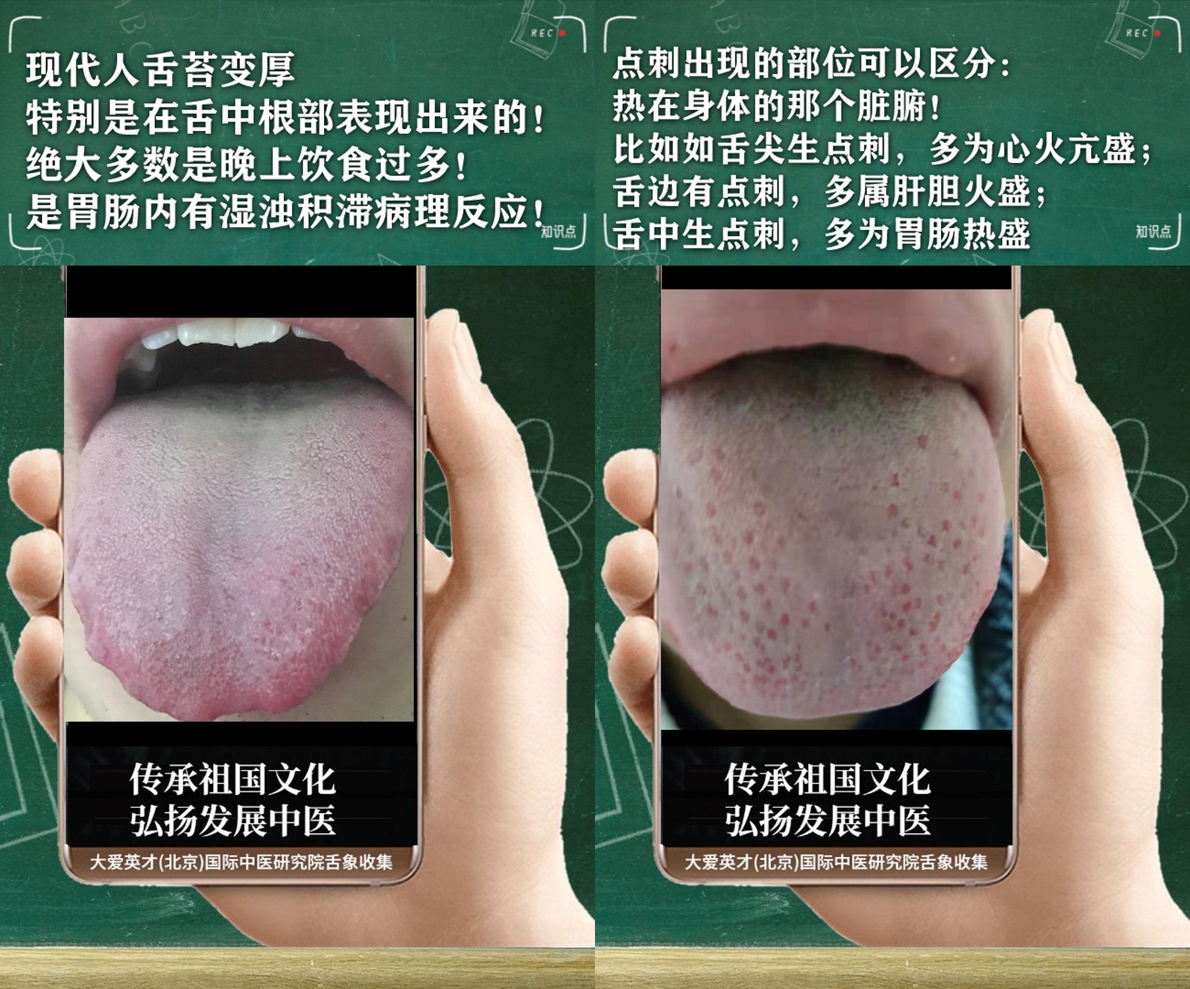 皮肤病|中医解析：工作效率低下，经常咳嗽，口苦，脾虚肾弱