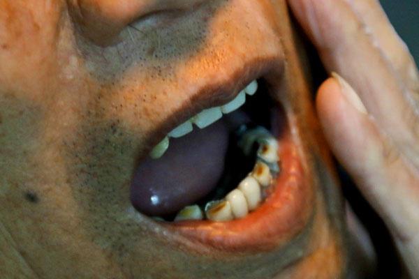 心脏|40岁以后，发现身体出现几处疼痛，可能是血管堵塞的预兆