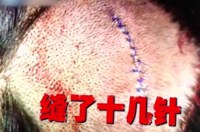 女子海洋馆游玩被割掉头皮,去索赔却遭暴力殴打,负责人态度嚣张