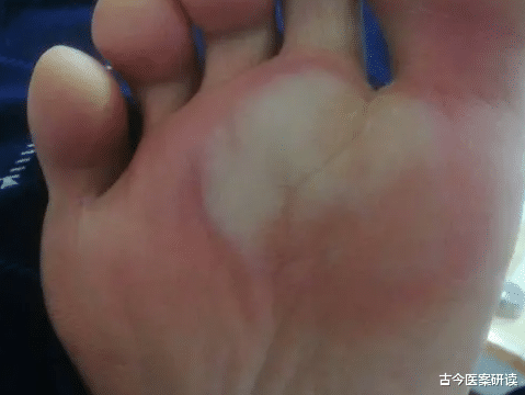 微量元素|肝不好，脚先知！提醒：脚上若有4种异常，多半肝已烂如渔网