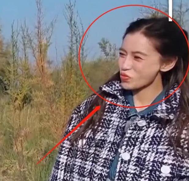 李一桐|笨蛋美女好敬業！李一桐錄制《跑男》牙崩仍堅持拍攝，喜劇人實錘