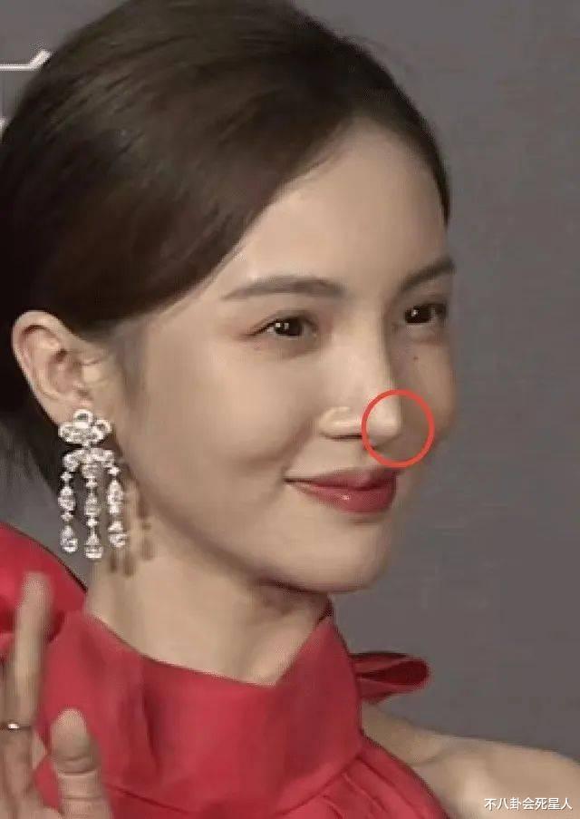 金赛纶|女星整容一直在路上：沈梦辰近照不敢认，杨子姗换个角度就变脸