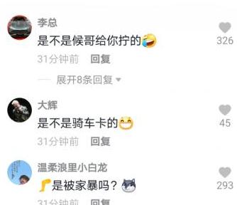 |“痞幼”到朋友家做客,胳膊淤青被质疑遭家暴,本尊回应尽显无奈