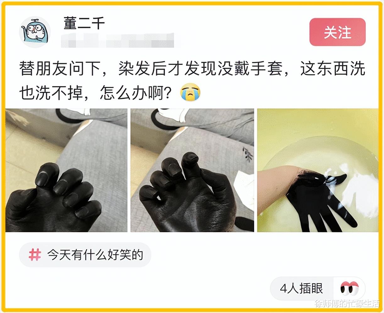 手套 “染头发的时候忘记戴手套了，怎么洗不掉...”这是幕后黑手？