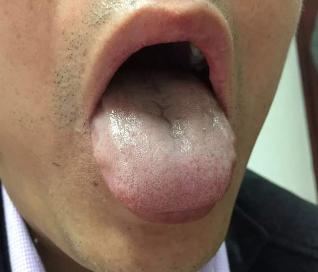 蔬菜|腿凉就是阳虚？听听中医怎么说，2味中药，补脾，温阳，散寒