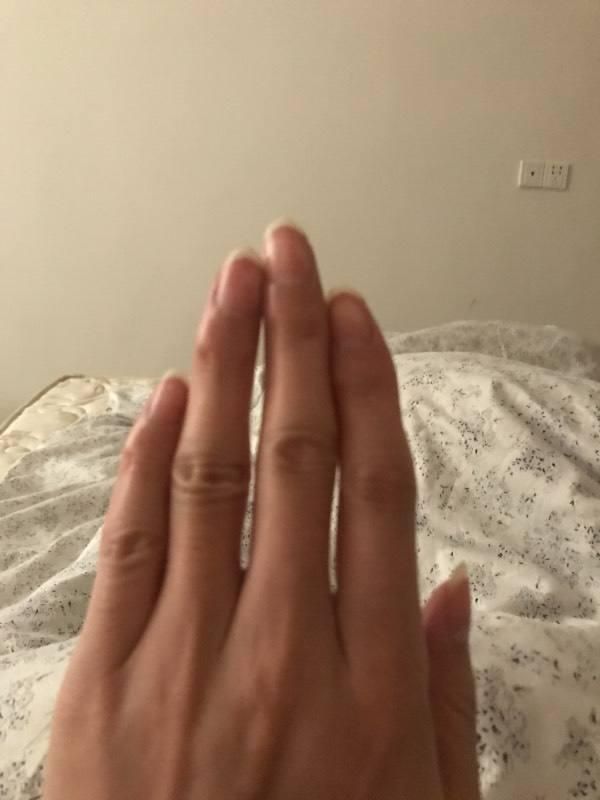 肝脏|肝是否健康?“竖起中指”看看,若无这6种表现,说明刚脏还不错