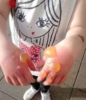 巨型猪草摸了就长巨型水泡,已在美国蔓延,会在中国泛滥吗?