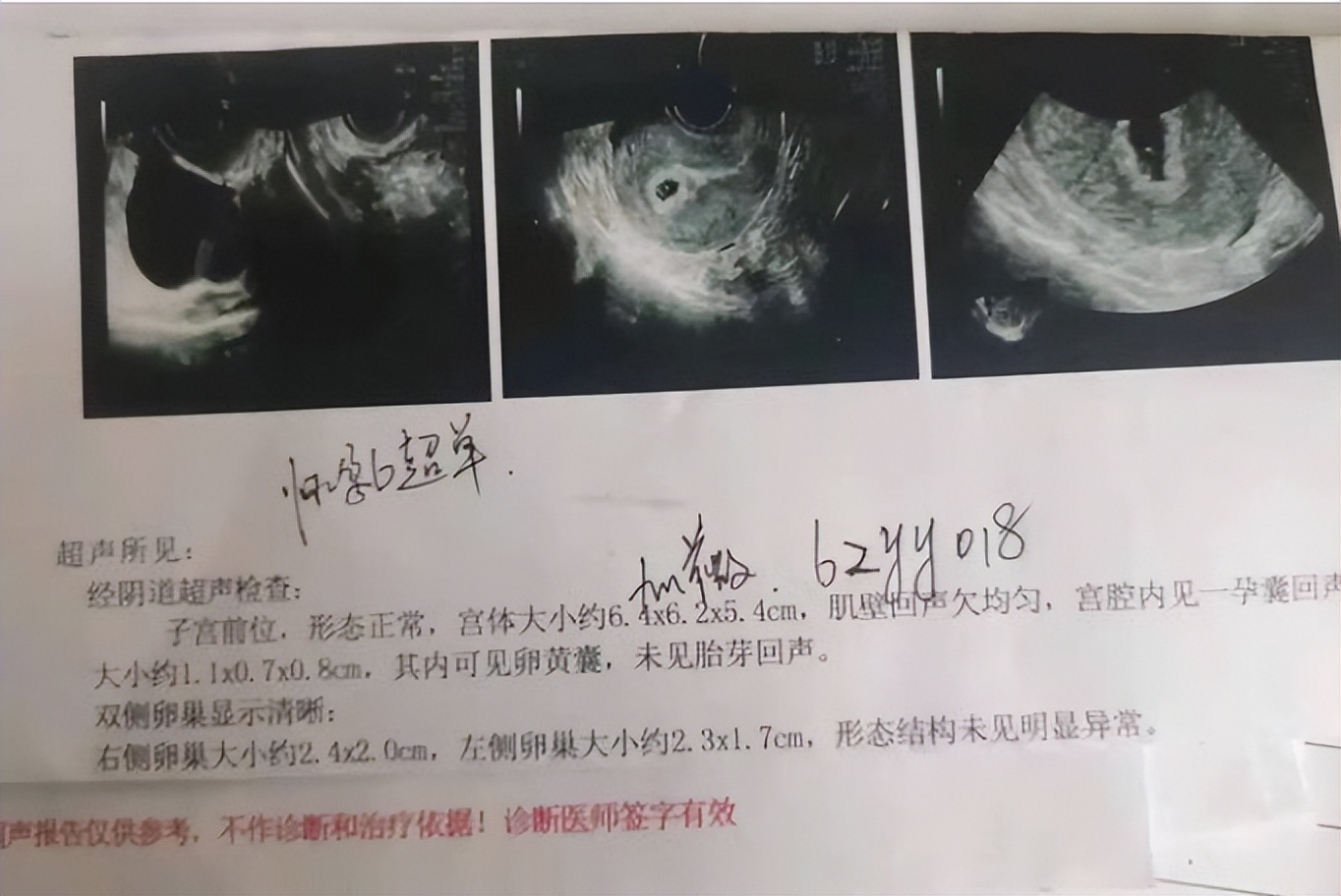 女子为10万元将老公借给闺蜜回顾,不成想却怀孕,一句话酿成悲剧
