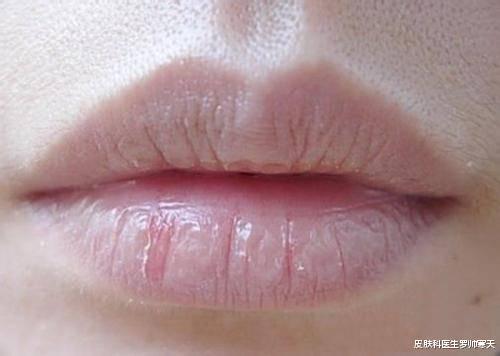 睡眠 科学四步，教你们唇部保养