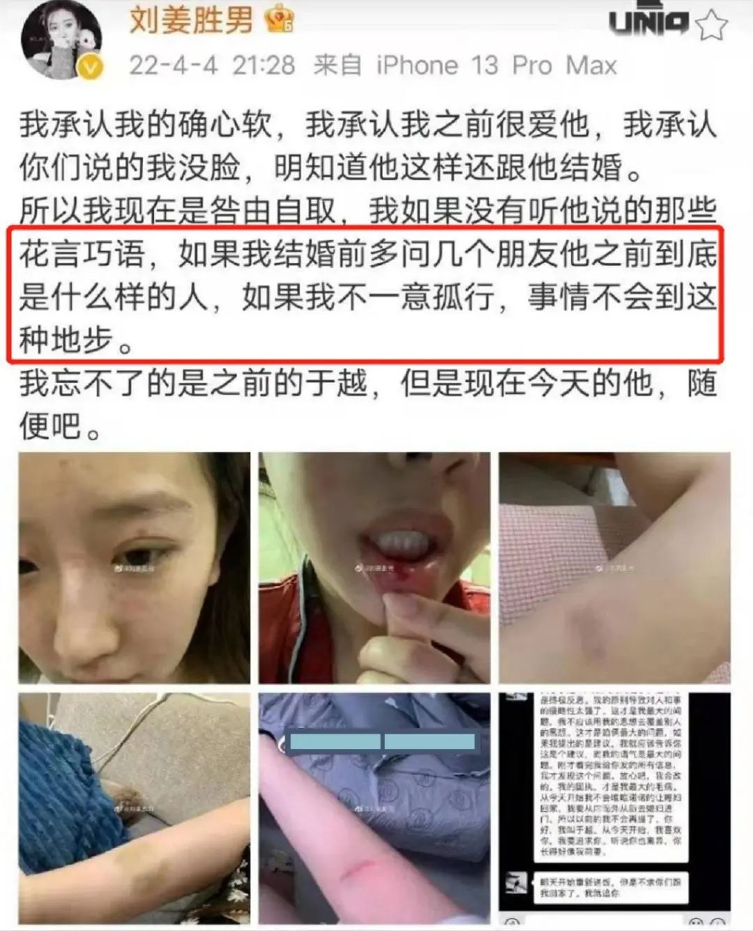 情侣|百万美女网红自曝被家暴,结果反转,出轨堂弟还打人!