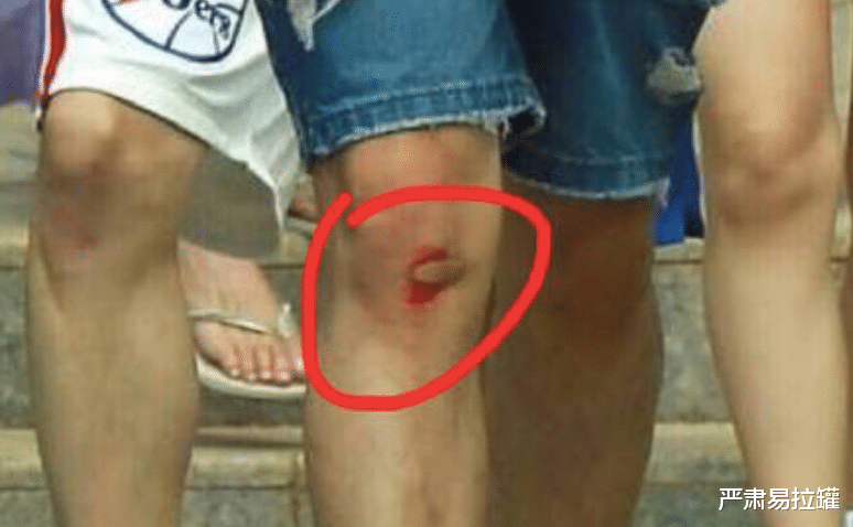 谢娜|谢娜又挨骂了