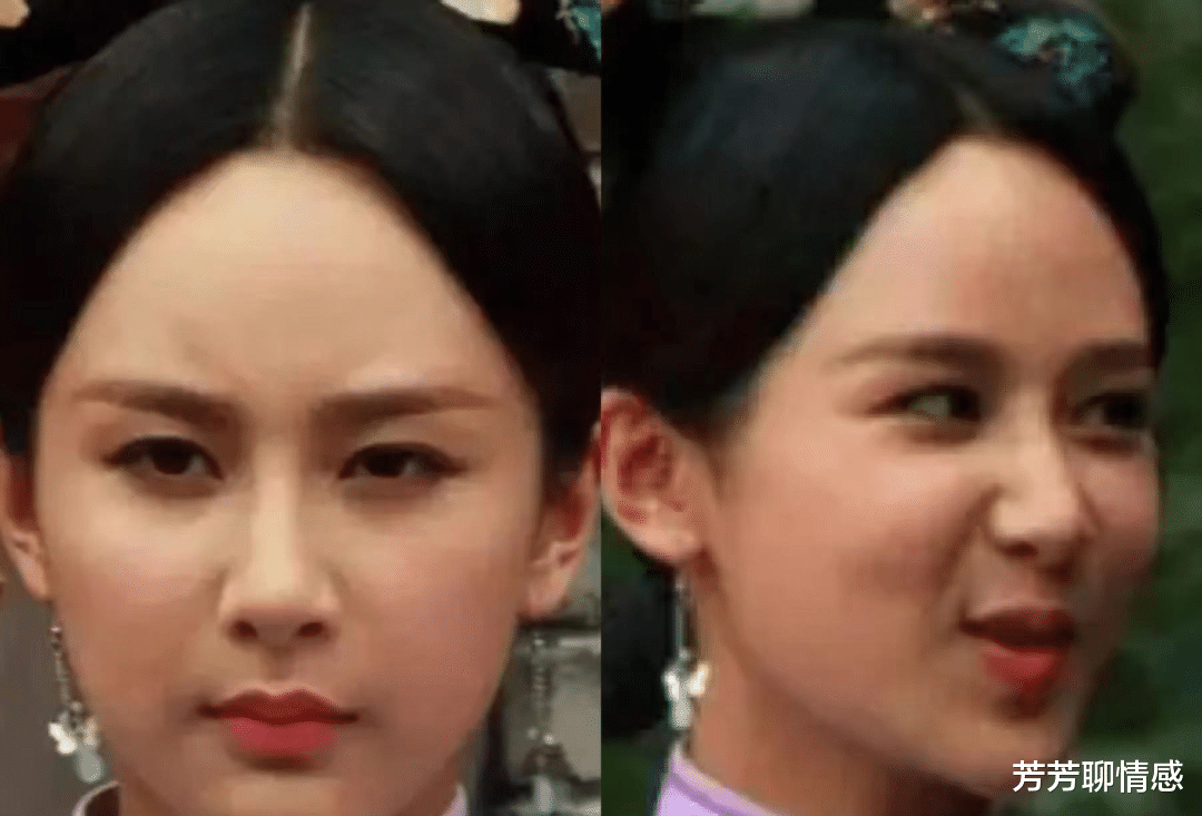 杨紫|女星“动脸”也靠运气！杨颖钟楚曦脸蛋自然，杨紫金晨却有后遗症？？