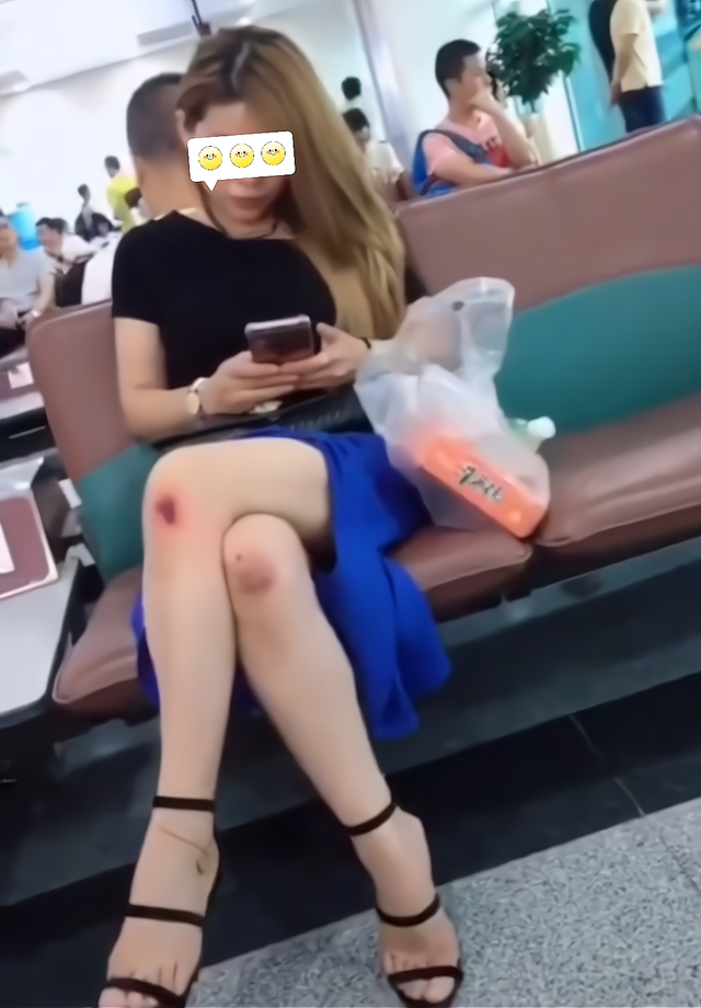 男子候车室遇漂亮女子,以为是缘分的开始,她腿上的伤却让他伤心