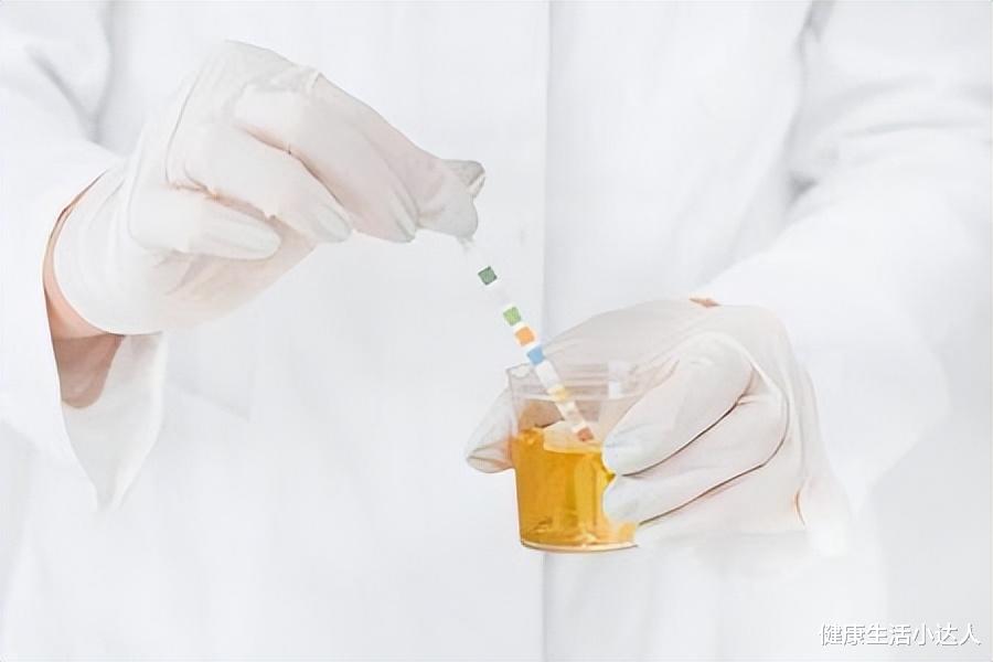 尿酸|揭秘高尿酸的三大表现, 预防痛风,稳定尿酸,做好4件事