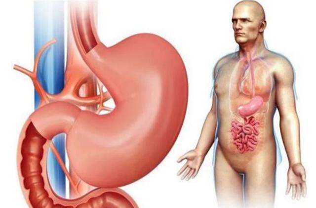 胃病|患了慢性胃病应该注意什么呢？在生活中需注意什么呢？