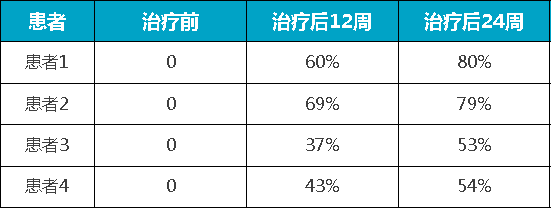 脱发|再生率高达80%！干细胞改善脱发促进毛囊再生
