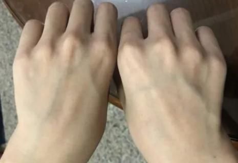 运动|有的人手臂“青筋暴起”,而有的人几乎看不到青筋,哪种更健康