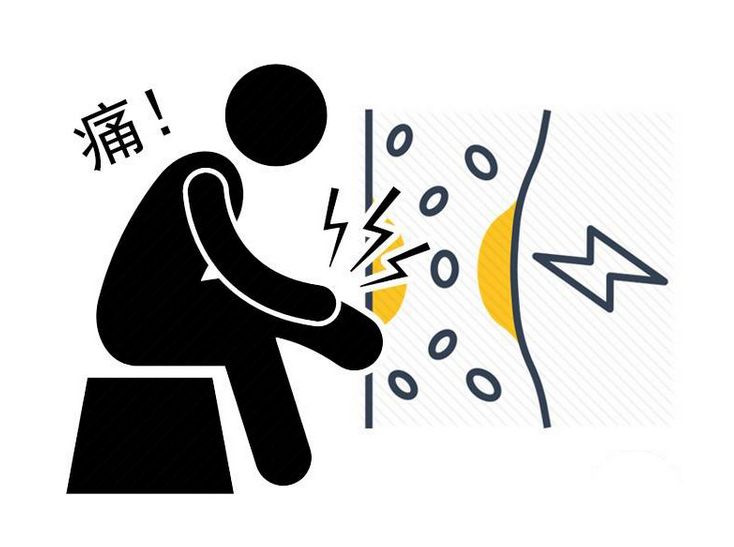 血栓|血栓会被身体溶解?不瞒你说:常吃3类食物,可清理血管垃圾