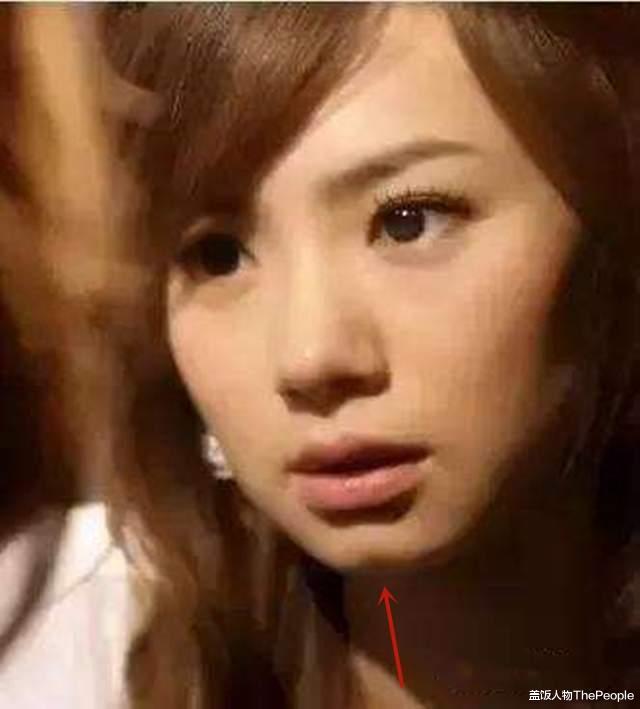 林青霞|美人沟下巴有多好看？林青霞下巴凹陷成经典，戚薇变尖却失辨识度