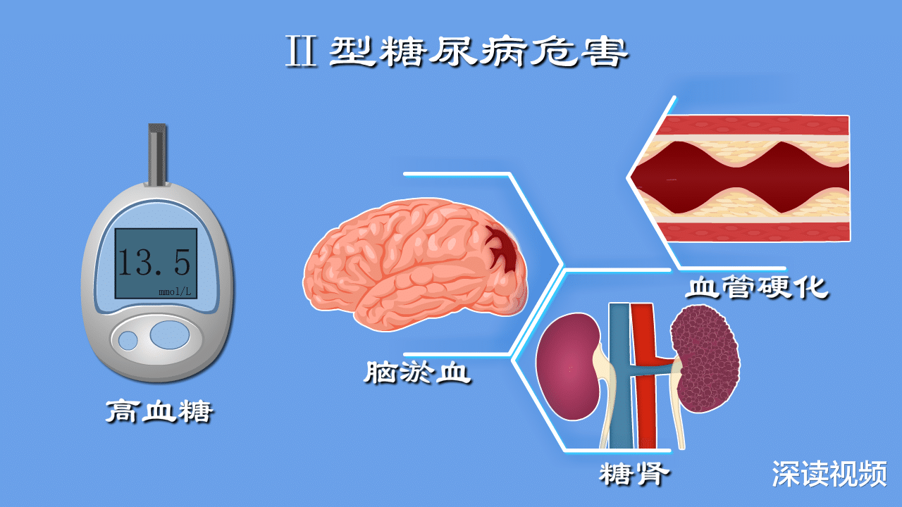 2型糖尿病|脑梗脑淤血谁之过？心脑眼肾被谁作死？2型糖尿病犯罪实录！细节
