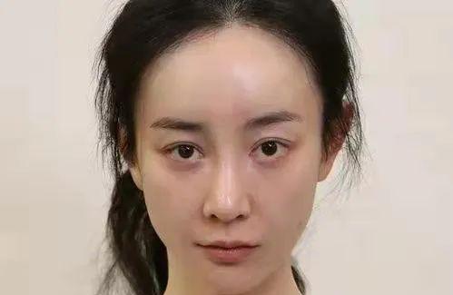 郭碧婷|6位女星的五官和脸,热巴左脸凹陷,郭碧婷左右脸不对称