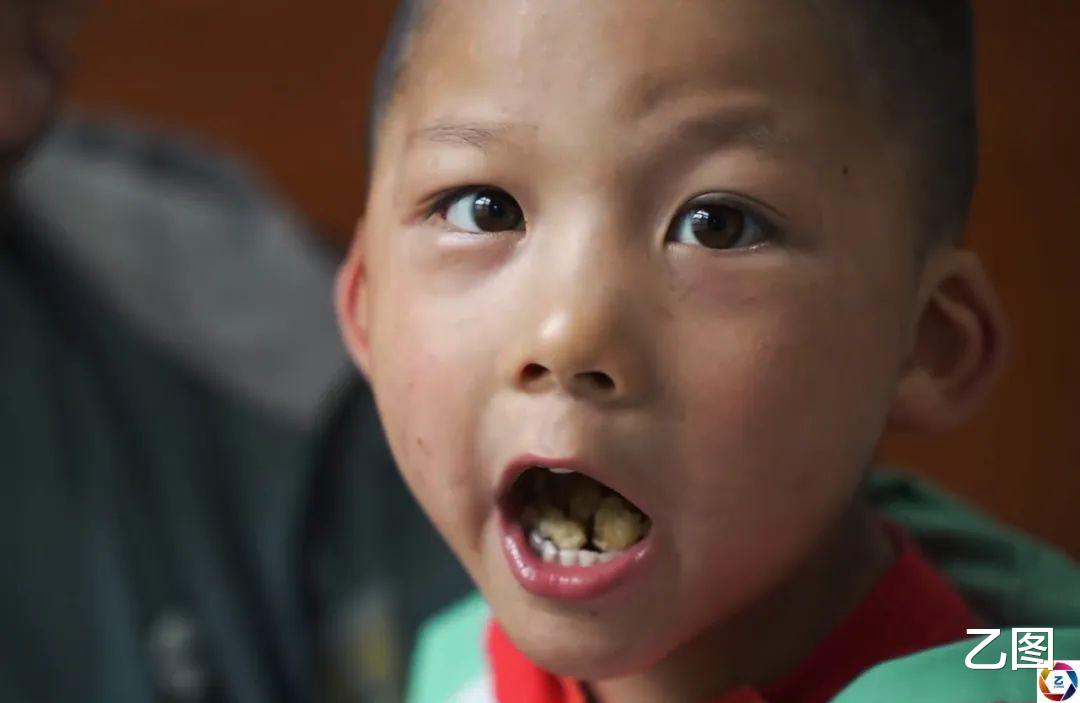 妻子瘫痪三个孩子均患病,男子一月挣一千元养全家,分身乏术