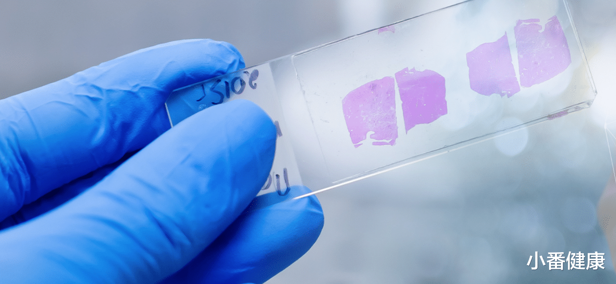 乙肝|乙肝在研新药BJT-778,及BJT-754两种新机制,将推向人体临床开发