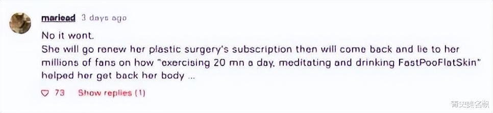 产后恢复|卡戴珊家族最美女人曝产后肚皮松垮难恢复：这才是产后正常的样子