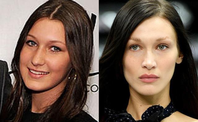 赵丽颖|超模贝拉哈迪德承认整容,14岁时改造了鼻子,妈妈遭抨击