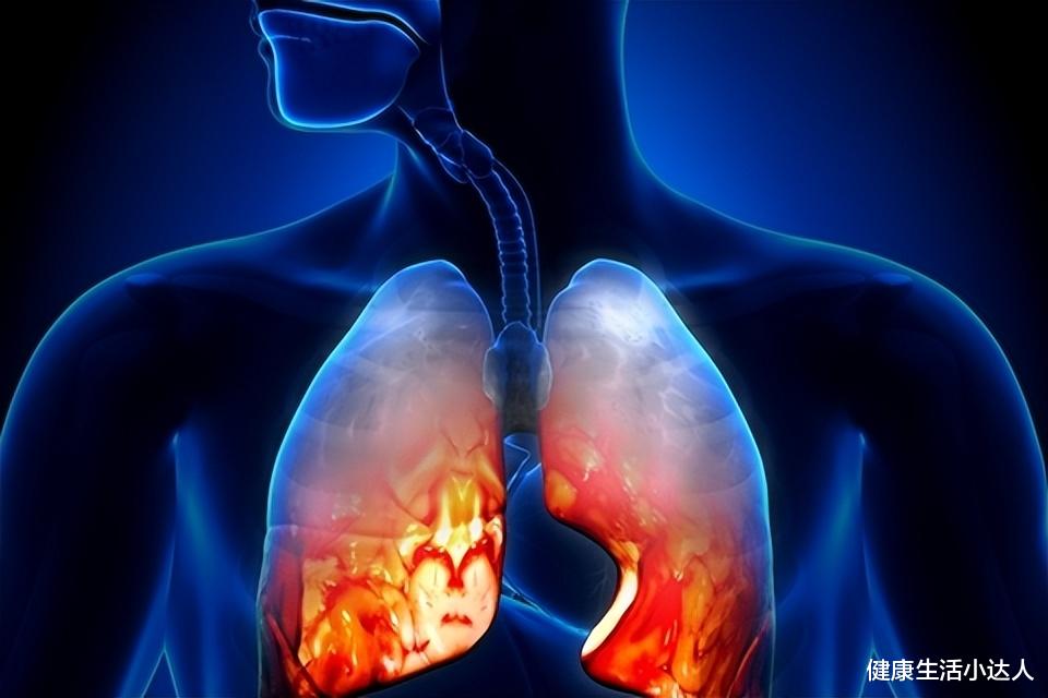 咳嗽|一旦身体有5个表现,糟糕了,是肺不好了,抓紧养肺吧