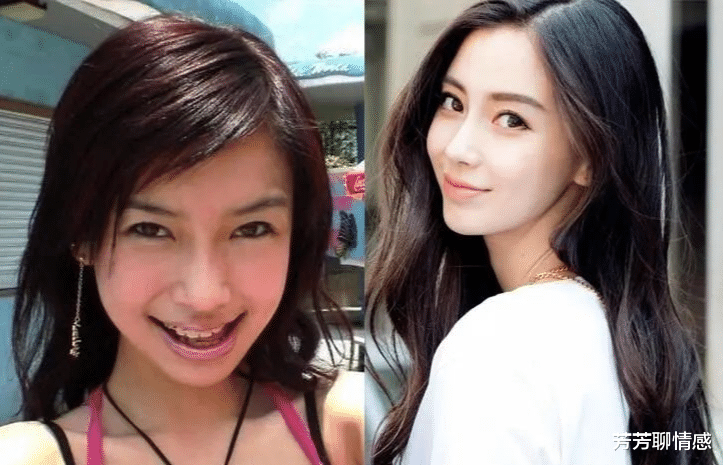 杨紫|女星“动脸”也靠运气！杨颖钟楚曦脸蛋自然，杨紫金晨却有后遗症？？