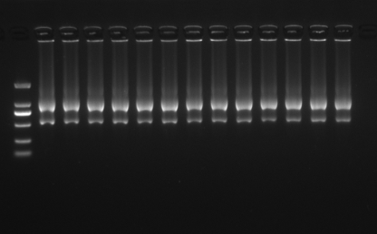 RNA 提取步骤(trizol)