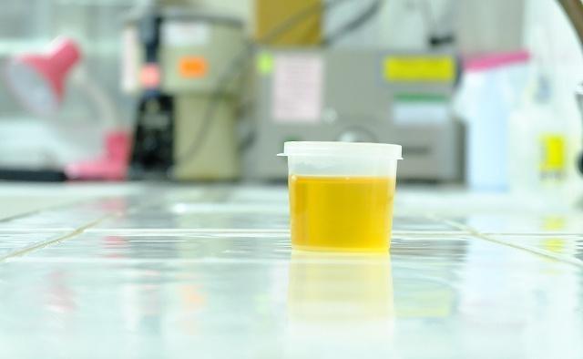 长寿|尿尿时若有这种“感觉”,可能是患上了前列腺炎,不妨自测一下