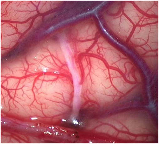 医生|突然左脸麻麻喊老公也发不出声，她害怕之余想起6个月前医生说过的话……