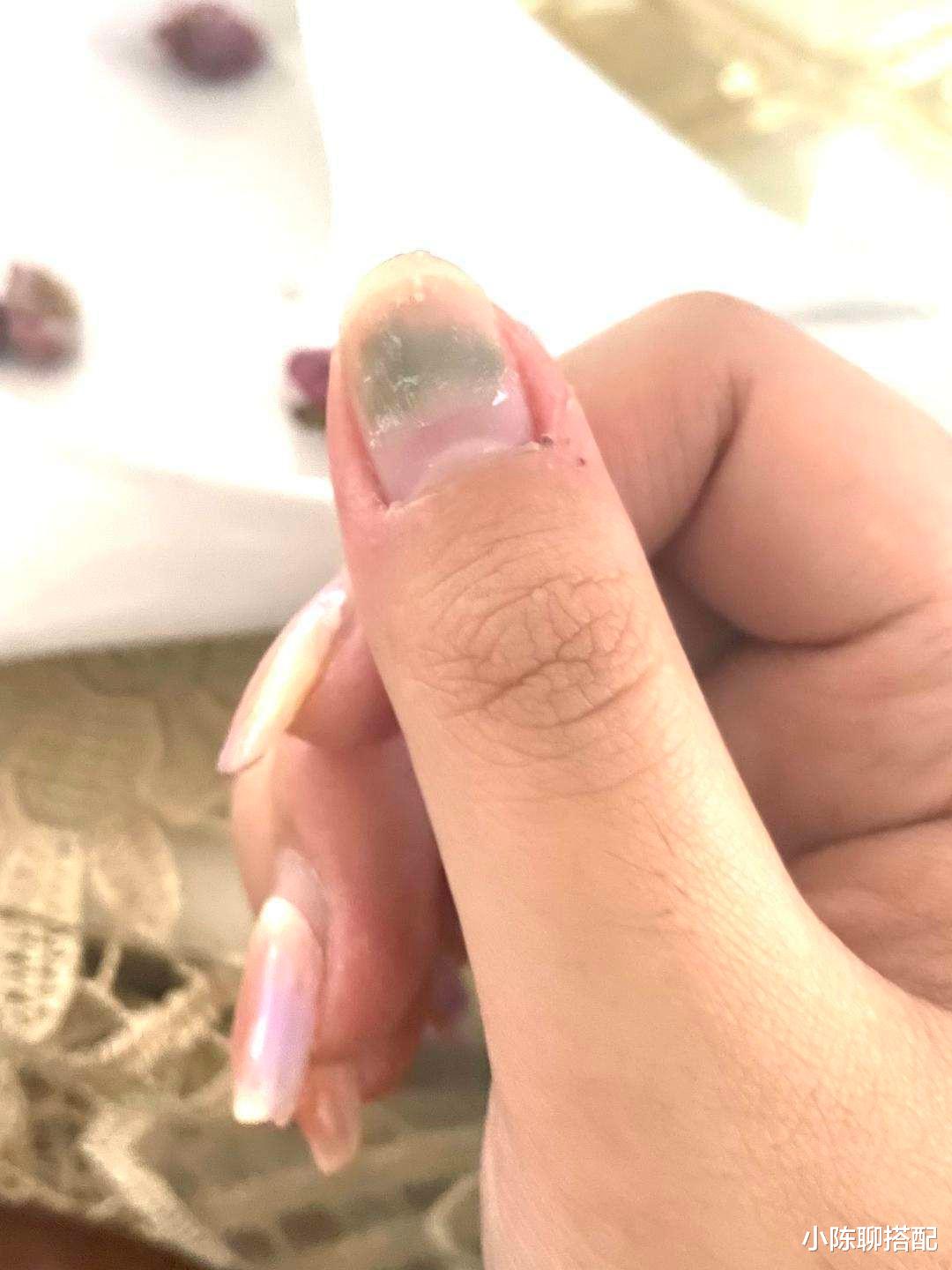别让双手毁了你的优雅！讲究的女人都不会忽略这3个手部问题