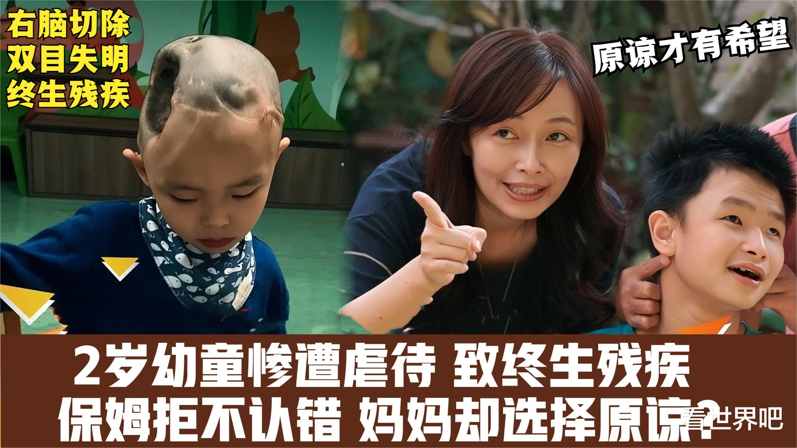 2岁幼童遭虐待,右脑切除偏瘫失明,保姆拒不认错妈妈却选择原谅