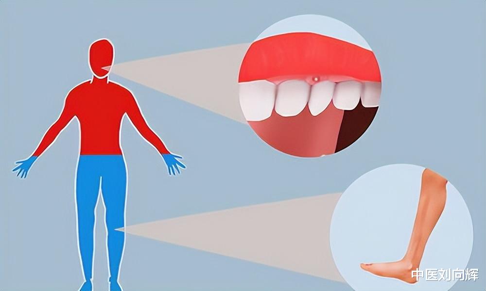 咳嗽|明明体寒,却经常上火?送你2味药,清热、散寒,改善反复上火