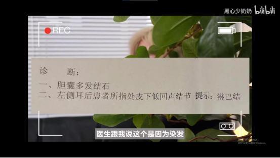 瓜子 过年回老家，到处是染发失败的年轻人