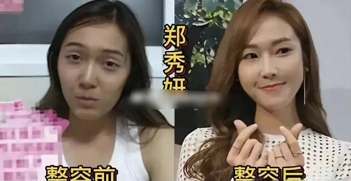 |原来这些韩国明星都整过容。