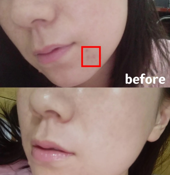 黑头 全网公认“恶心”国货首次曝光！蜂花香皂高级，澳芙泥膜黑头克星