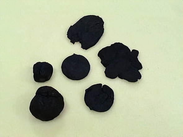 心脏|造福天下的补血方!失眠多梦、易醒、焦虑烦躁、头晕乏力,一扫光