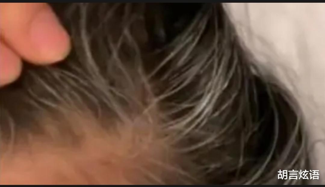 网红博士称自己上当受骗,身边不少人是肺炎,几乎每天都有人离世