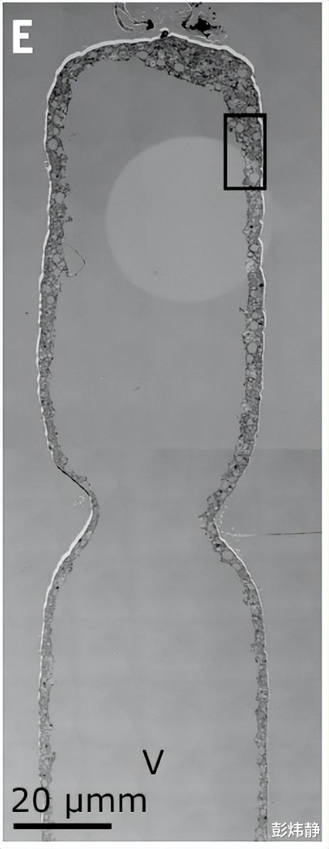 细菌中的“珠穆朗玛峰”现身!长达2cm, 肉眼可见