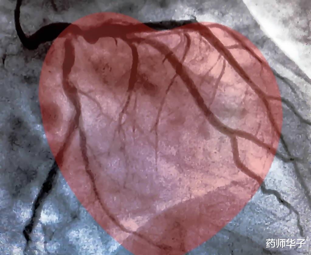 黄瓜|关于心脏的各种检查,都有什么作用,哪个可以预知心梗?